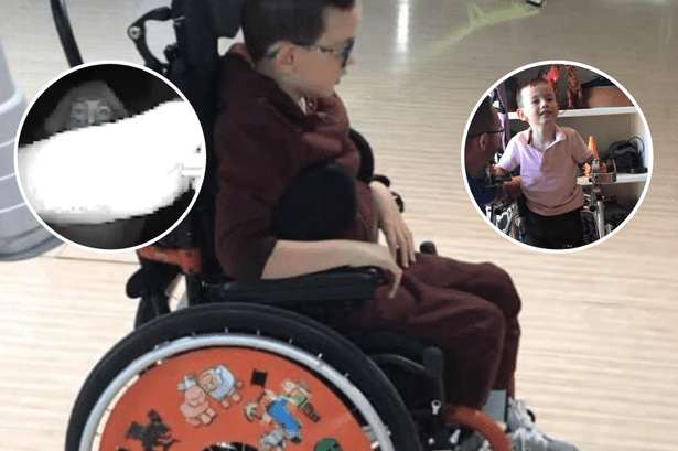 Kyle Fitzgerald with cerebral palsy has thieves steal wheelchair from him.